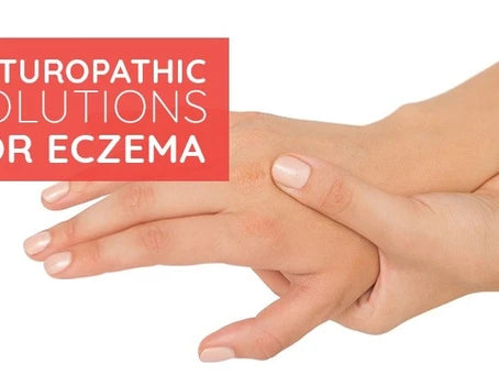 how do you cure eczema